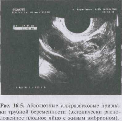 Горожанина Светлана Владимировна - врач, доктор, Новосибирск Глава 2. ПСИХОЛОГИЧЕСКИЕ ПОСЛЕДСТВИЯ РАЗВОДОВ / Супружеская перестрелка